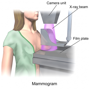 Mammogram breast screen van caravanning traveling on the road Australia